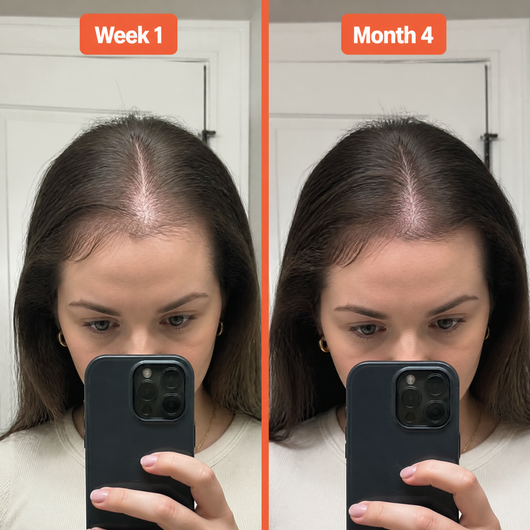 Biotin Gummies for Hair Growth
