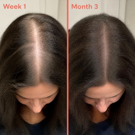 Biotin Gummies for Hair Growth