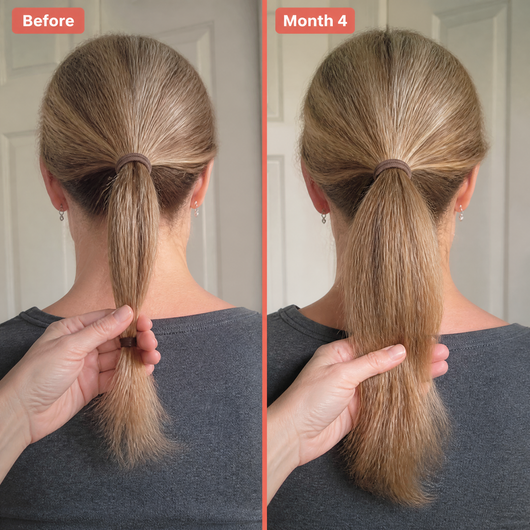 Biotin Gummies for Hair Growth