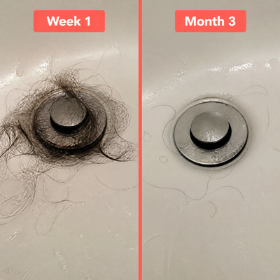 Biotin Gummies for Hair Growth